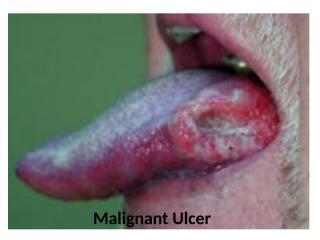 Malignant Tumours.pptx