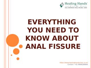 Everything you need to know about Fissures.ppt